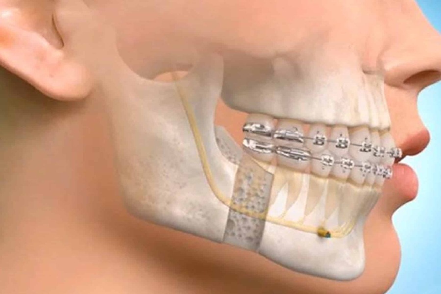 Maxillofacial surgery | Finedent dental clinics