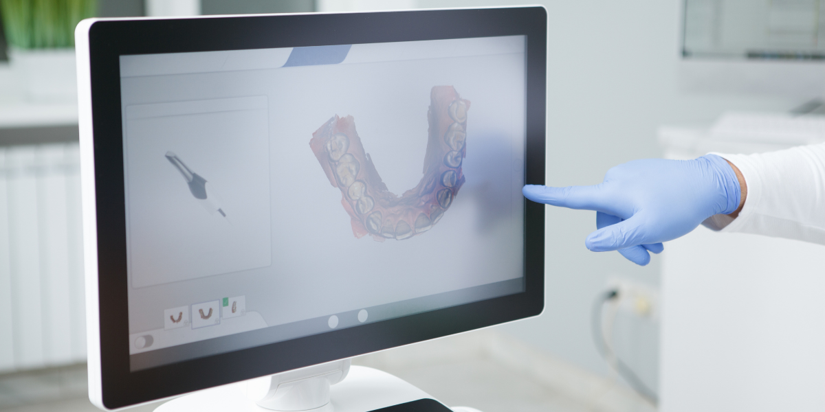 Smart Dental Treatments