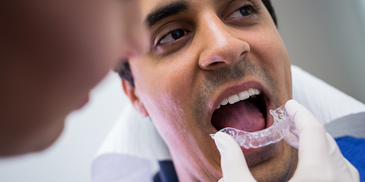 AI-Powered Invisalign Treatment