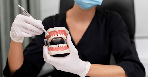 full mouth dental implants